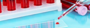 Blood Sample